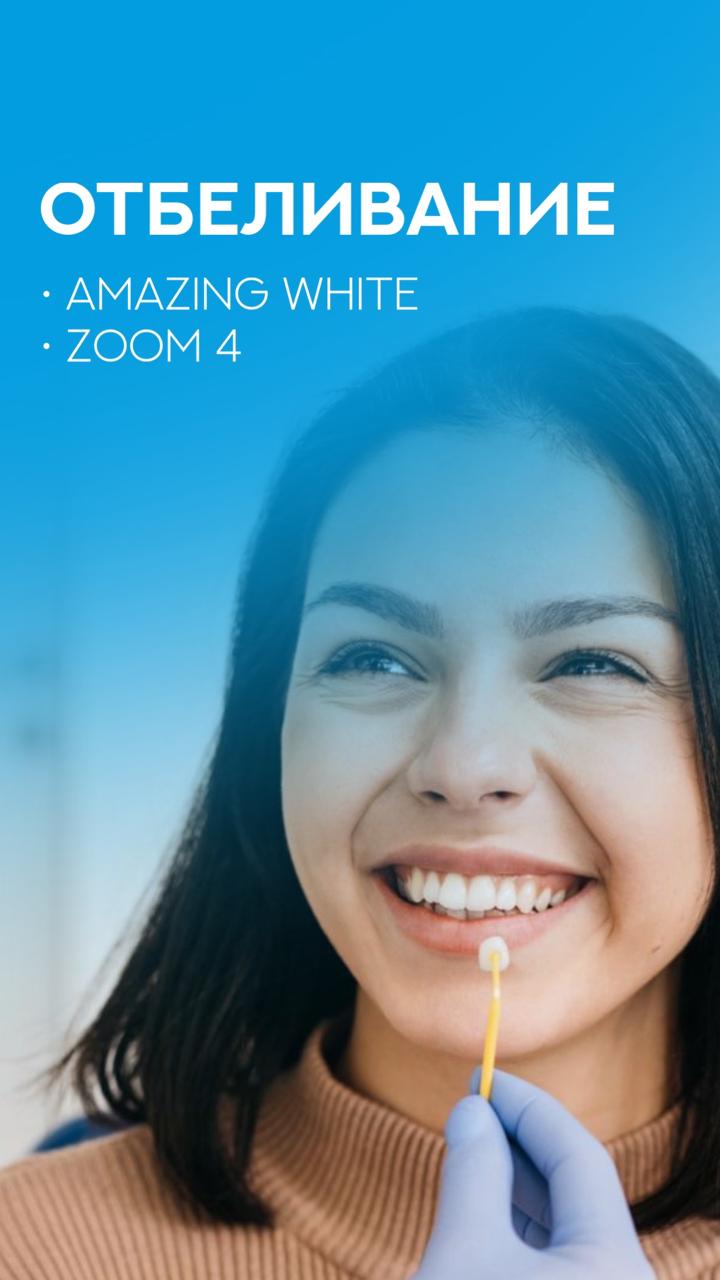 Отбеливание Zoom 4: что можно и нельзя после процедуры